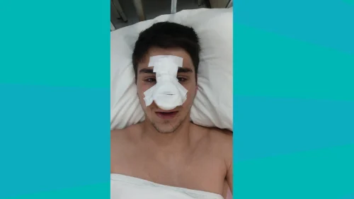 Snimak duela igrača Naših krila i Željeznilčara (video), Regionalna liga – Centar
