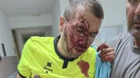 Nasilju nije mjesto u sportu.